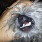 Fotografía Labio Leporino